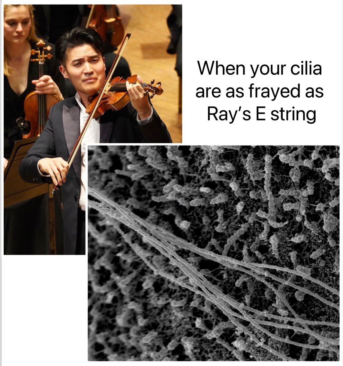 For better looking cilia, see our new preprint 👇

biorxiv.org/content/10.110…

SEM by Sanja Sviben and <a href="/ajpolino/">Alex Polino</a> 
Inspiration by <a href="/raychenviolin/">Ray Chen</a>