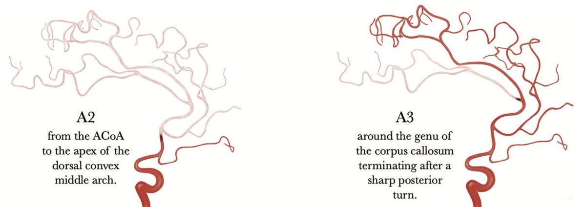 Lukas Meyer (@meyerl_md) on Twitter photo Thrombectomy seems feasible/safe for ACA-DMVOs. No diff in outcomes->Patient selection remains unclear/crucial. Reinforcement of clinical equipoise for RCTs ->randomize pts!
<a href="/Fie0815/">Jens Fiehler</a> <a href="/MPeyT1/">Marios Psychogios</a> <a href="/uta_hanning/">Uta Hanning</a> <a href="/BroocksGabriel/">Gabriel Broocks</a> <a href="/P_Papanagiotou/">Panagiotis Papanagiotou</a> <a href="/CheesemakerMD/">Johannes Kaesmacher</a> <a href="/DoctorGaldamez/">Mario Martínez-Galdámez</a>
#TOPMOST Thrombectomy seems feasible/safe for ACA-DMVOs. No diff in outcomes->Patient selection remains unclear/crucial. Reinforcement of clinical equipoise for RCTs ->randomize pts!
<a href="/Fie0815/">Jens Fiehler</a> <a href="/MPeyT1/">Marios Psychogios</a> <a href="/uta_hanning/">Uta Hanning</a> <a href="/BroocksGabriel/">Gabriel Broocks</a> <a href="/P_Papanagiotou/">Panagiotis Papanagiotou</a> <a href="/CheesemakerMD/">Johannes Kaesmacher</a> <a href="/DoctorGaldamez/">Mario Martínez-Galdámez</a>
#TOPMOST