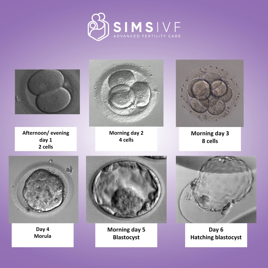 simsivf's tweet photo. Take a look at the stages of embryo development in the lab from day 1-6. 😍

#Fertility #ivf #embryo #ivfireland #SimsIVF #fertilityjourney #embryologist #lab https://t.co/Mi6ZrtSMRK