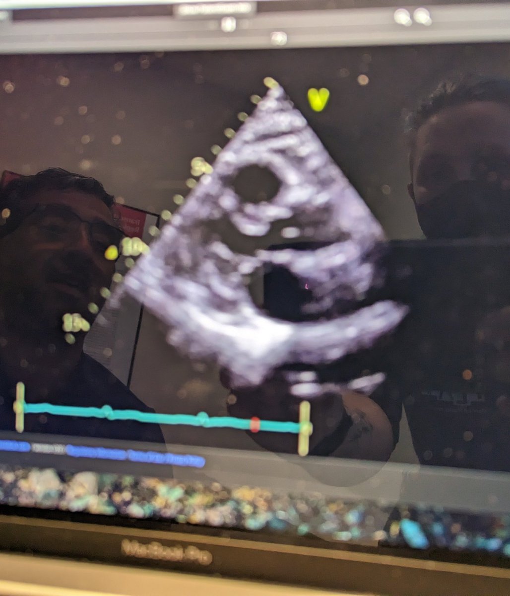 As a belated Valentine's thing, here's my cardiologist and I looking at an ultrasound of my heart. Cool! And on theme!