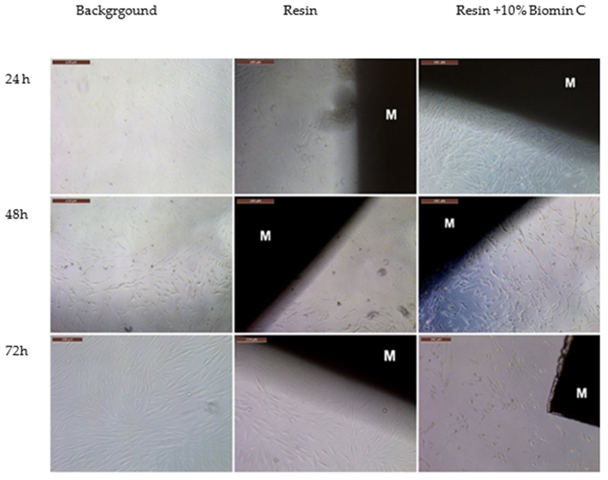 JFB_MDPI's tweet photo. 💚Paper Recommendation From @JFB_MDPI @ChemMatSci_MDPI
📖#Mechanical Properties and #Biocompatibility of #3D Printing Acrylic Material with Bioactive Components
📌https://t.co/GydSiotJUQ
#BioactiveGlass #IonRelease https://t.co/dShcJKXZze
