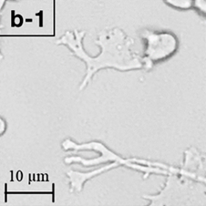 Foto de microscopio de la ameba como filamentos largos. Escala de tamaño de 10 micrómetros. Referencia: YAMANOUCHI, K., ARIMA, H., SAKAMOTO, Y. ET AL./WIKIMEDIA COMMONS