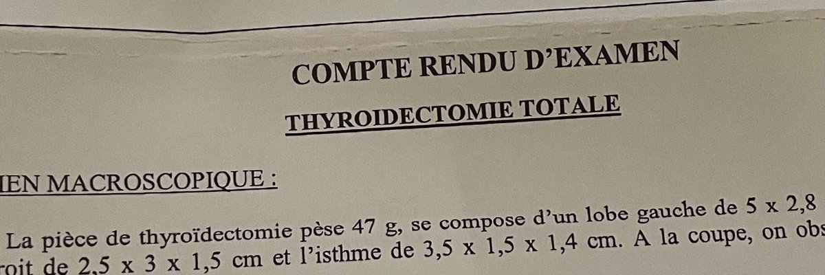 doccotte's tweet photo. Drame en deux actes https://t.co/H2HRXUhgFC