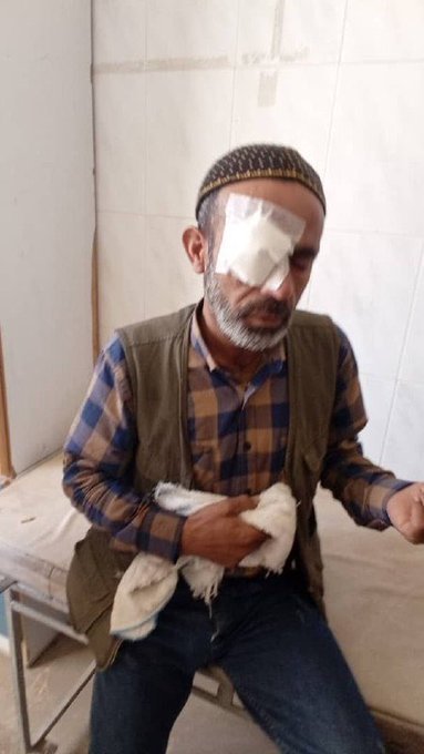 YPJ_Info's tweet photo. ⚡ While people are still recovering from the #earthquake, #Turkey continues to attack the affected areas
➡️ Today, #TilRifat was bombed again
➡️ As a result, a 70 year old civilian lost his life & another one was wounded
#Syria #AANES #Rojava #TurkeyAttacksRojava https://t.co/zFtwSfQTnt