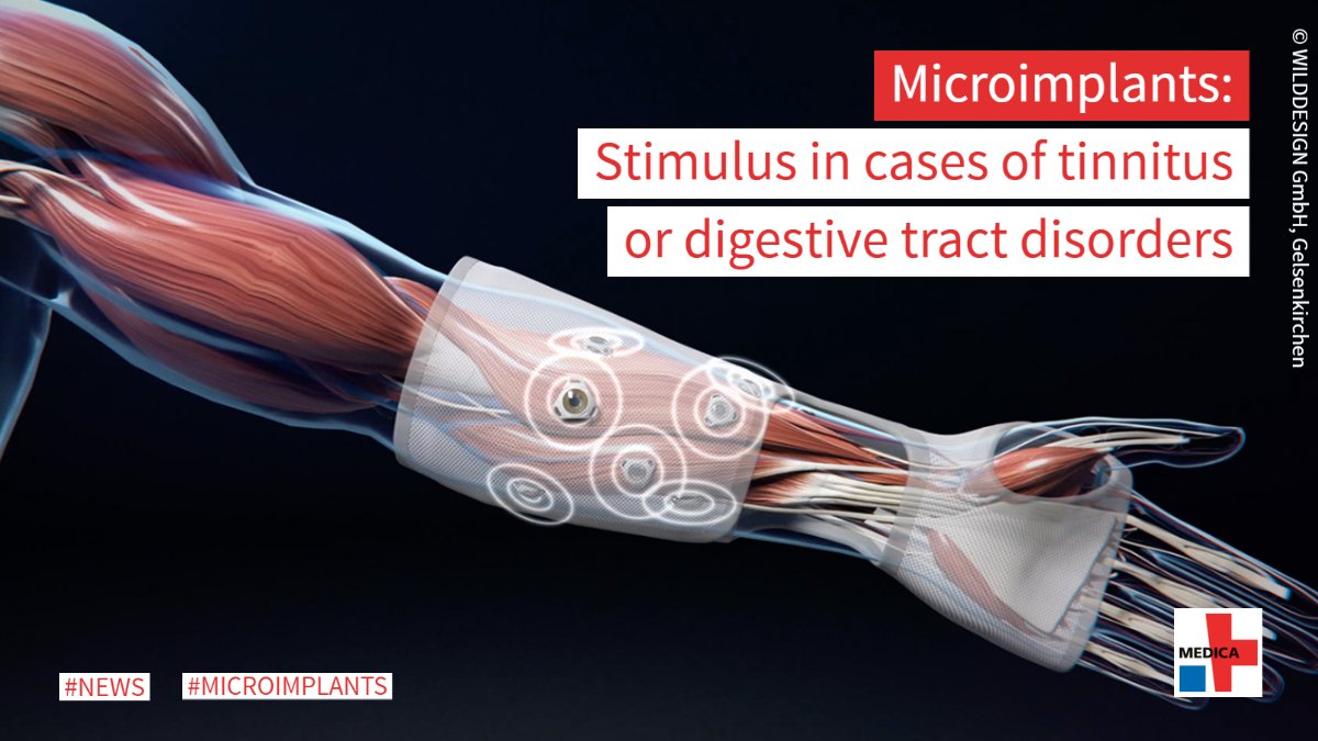 MEDICATradeFair's tweet image. The new generation of interactive #microimplants can help people with functional limitations in their daily lifes, e.g. when they help the hands to grip again or when they act as a stimulus in cases of tinnitus or digestive tract disorders.
👉 #MEDICANews: sohub.io/hx2a