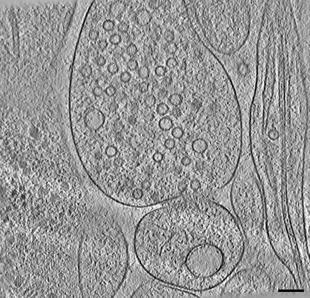 Anna_siegert1's tweet photo. What a beautiful #synapse! We used #ORSDragonfly for automated neural network based segmentation! @PetrovicArsen #teamtomo #teamsynapse https://t.co/KsuJy72Vu4