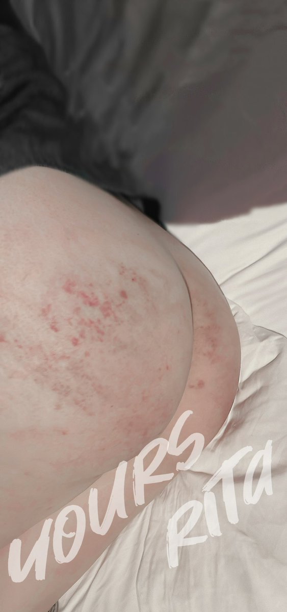 【可爱不是长久之计】
【可爱你是长久之计】

小崽子每次挨揍疼了
都哭诉说我不爱她

拜托 
两个小时就能从图一恢复到图二
这难道不就是爱的轻抚吗
(其实是因为大杀器这次忘了带 最近关口每天游客都很多  懒得跑回去拿了)

#spanking  #小圈 https://t.co/5xrehcZSbA