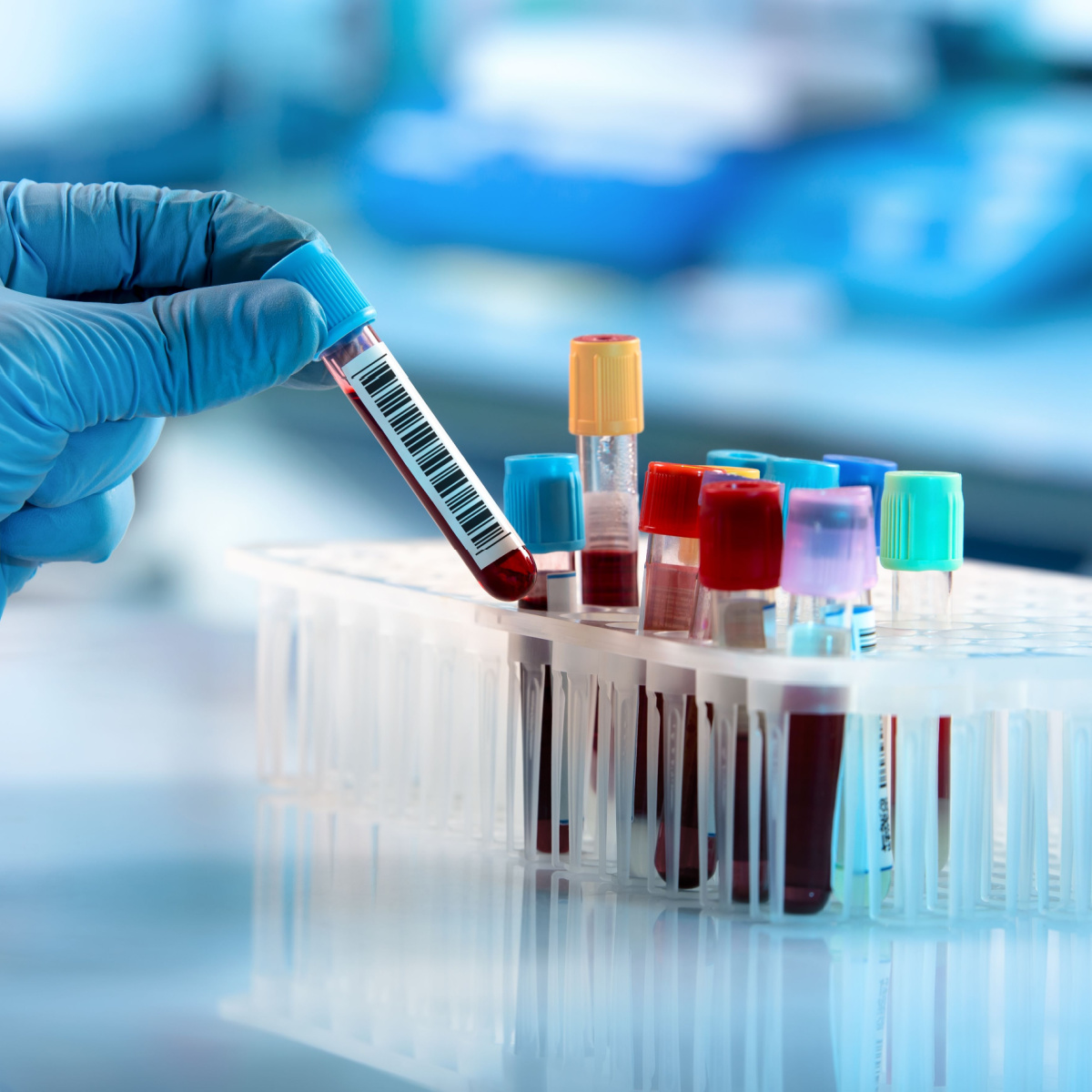 drchadedwards's tweet photo. Revolution Health and Wellness goes the extra step in gathering lab data so we can better care for our patients. Check out how detailed our labs are here: https://t.co/iRxIyfqk4y https://t.co/SuIpFhTJH7