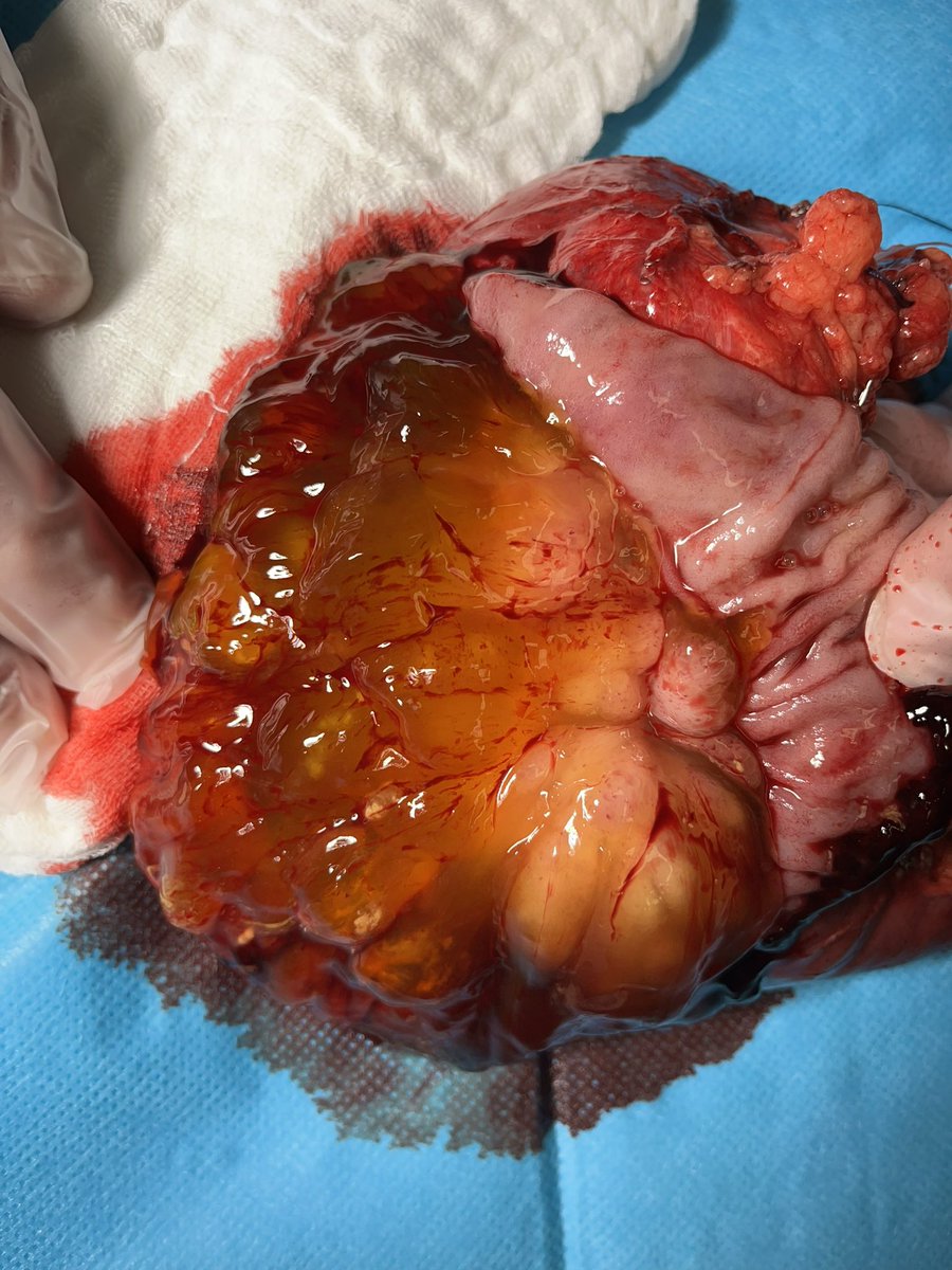 Giovanni Marchegiani tweet media