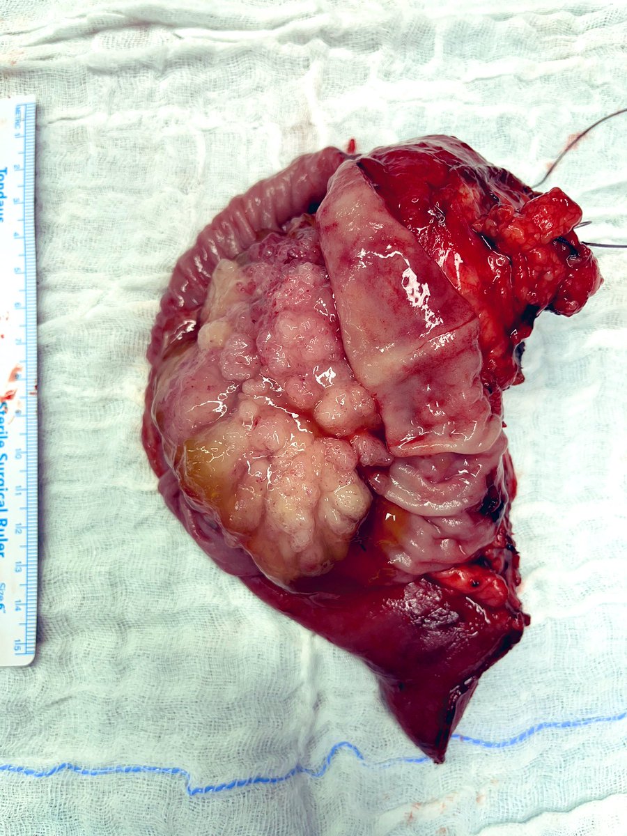 Giovanni Marchegiani tweet media