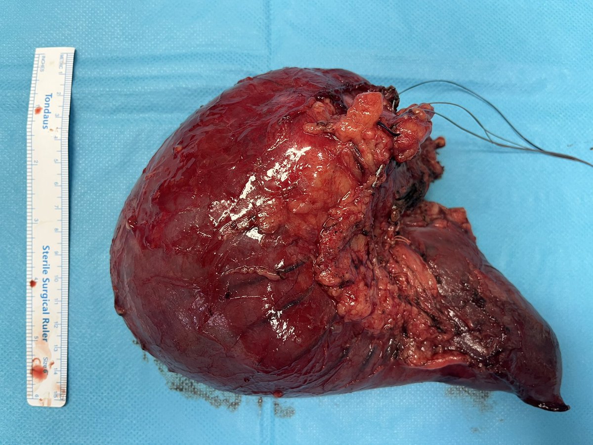 Giovanni Marchegiani tweet media