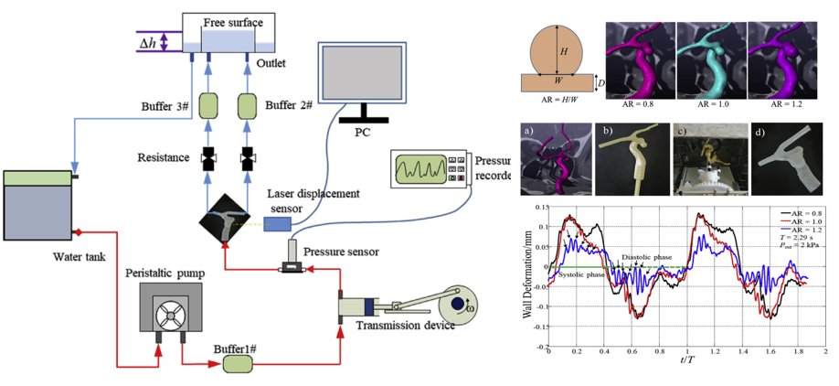 medntdj's tweet photo. In-vitro experimental study on the fluid-structure interaction in an image-based flexible model with a lateral cerebral aneurysm
https://t.co/cunvcTm9hj
#Patient specific aneurysm #In-vitro silicon model #Pulsatile flow #MedTwitter #scicomm #MedEd #AcademicTwitter https://t.co/fweLgBChiP