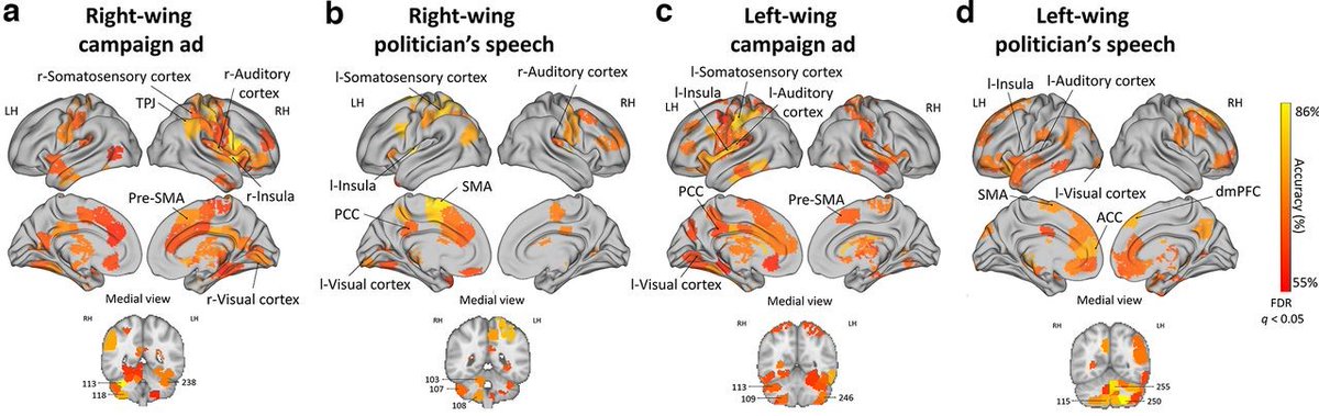 SfN Journals (@sfnjournals) on Twitter photo #JNeurosci: <a href="/KatabiNoa/">Noa Katabi</a> <a href="/YeshurunYaara/">Yaara Yeshurun</a> et al <a href="/of_sagol/">Sagol School of Neuroscience</a> <a href="/TelAvivUni/">Tel Aviv University</a> MRI scanned left & right-wing participants while watching political campaign ads & speeches. The results uncover fundamental neural mechanisms underlying processes of political polarization.
jneurosci.org/lookup/DOI/10.… #JNeurosci: <a href="/KatabiNoa/">Noa Katabi</a> <a href="/YeshurunYaara/">Yaara Yeshurun</a> et al <a href="/of_sagol/">Sagol School of Neuroscience</a> <a href="/TelAvivUni/">Tel Aviv University</a> MRI scanned left & right-wing participants while watching political campaign ads & speeches. The results uncover fundamental neural mechanisms underlying processes of political polarization.
jneurosci.org/lookup/DOI/10.…