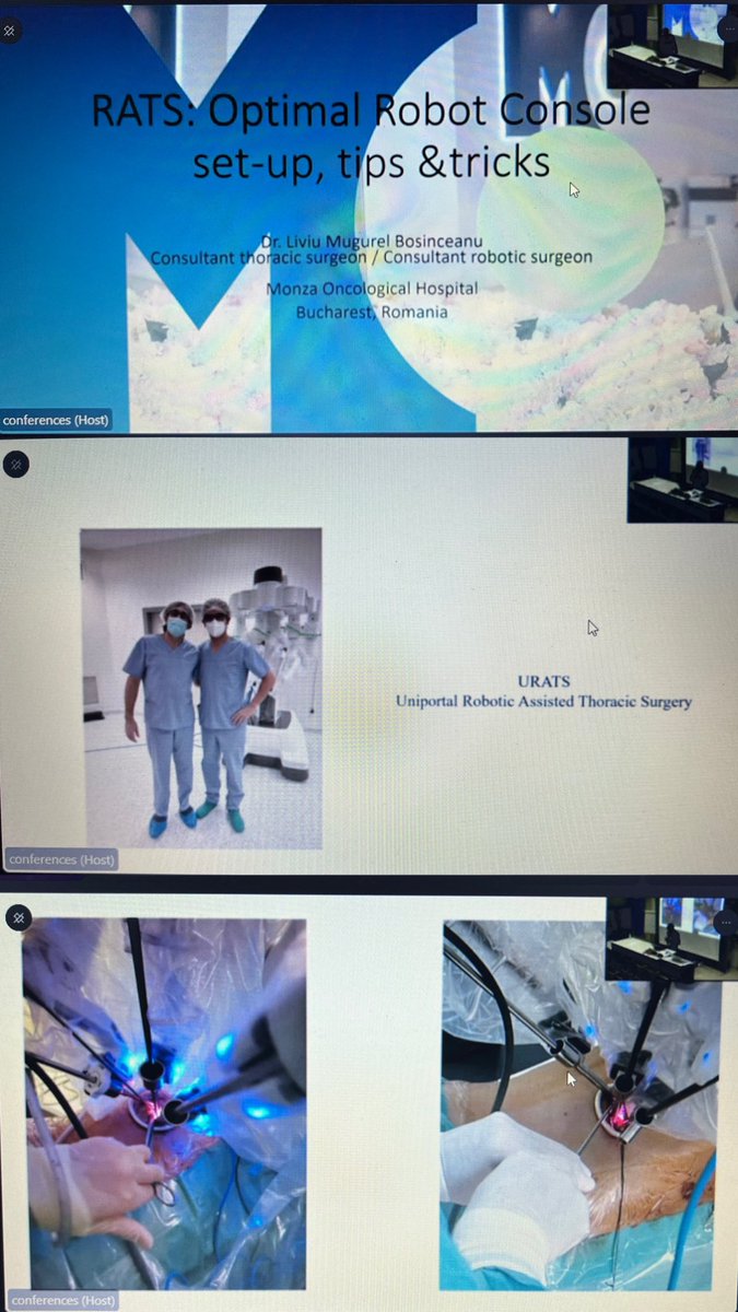 Sofia_WViana's tweet photo. Dr. Mugurel Bosinceanu presented a lecture that makes everything seem so simple!🫁🤍
You are amazing!
.
#MedTwitter #URATS #thoracicsurgery https://t.co/rERHd07uVF