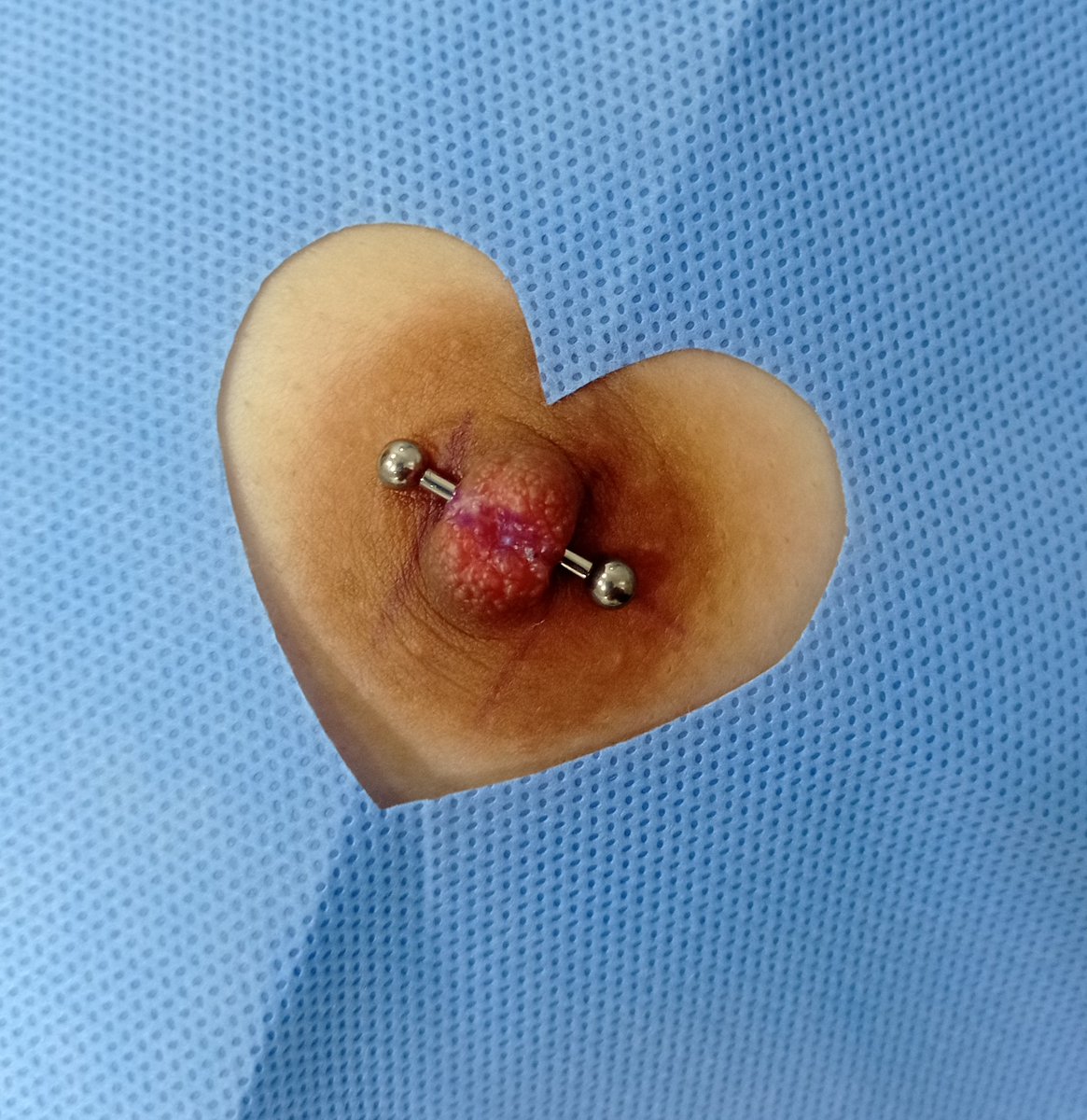 Um mamilo adornado com amor fica sempre mais bonito 🙈💙💙