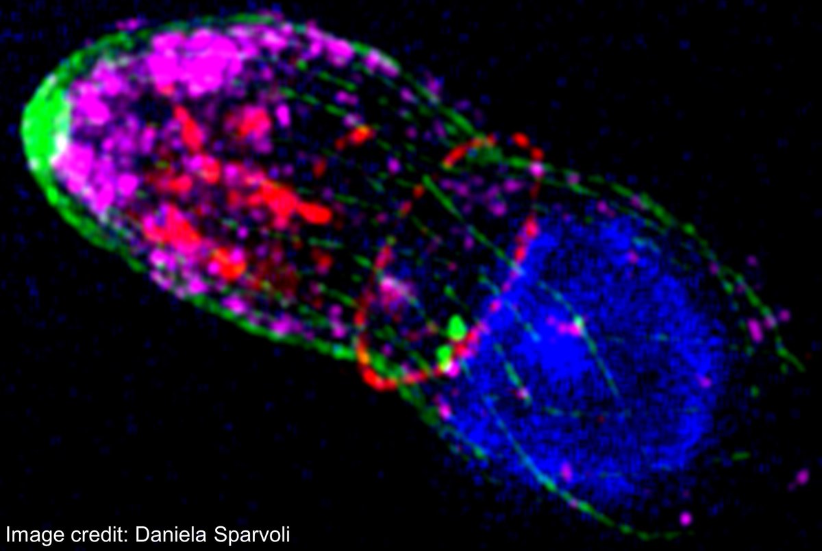 Lebrun (@lebrun43782700) on Twitter photo If you have recently graduated or you will graduate in 2023, we have the perfect Post-doc position for you : Explore the beauty of #Toxoplasma Cell Biology.
Apply before May 24th 2023. You can start between Oct2023 - April2024. Please contact me : maryse.lebrun@umontpellier.fr If you have recently graduated or you will graduate in 2023, we have the perfect Post-doc position for you : Explore the beauty of #Toxoplasma Cell Biology.
Apply before May 24th 2023. You can start between Oct2023 - April2024. Please contact me : maryse.lebrun@umontpellier.fr
