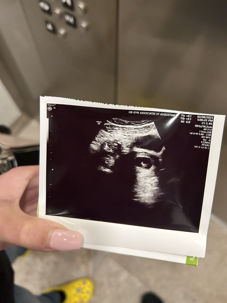 OGJuulz's tweet image. Baby Holland 🫶🏼