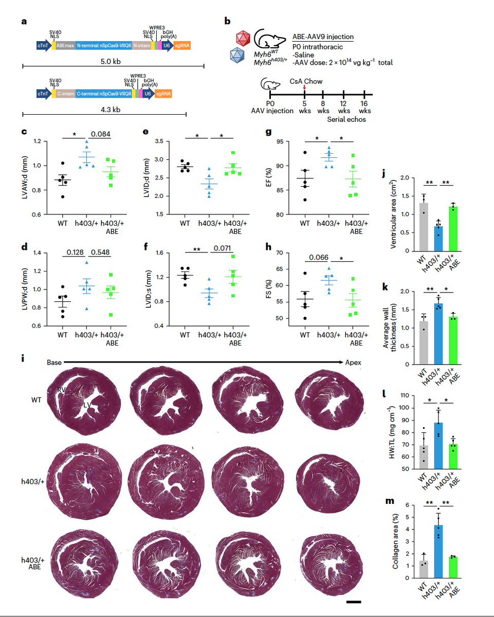 Eric Topol (@erictopol) on Twitter photo Exciting to see genome editing of hypertrophic cardiomyopathy to correct the pathogenic variant in the humanized mouse model, laying the groundwork for a potential cure in the future
nature.com/articles/s4159… <a href="/NatureMedicine/">Nature Medicine</a> <a href="/Transactivator/">Eric N. Olson</a> <a href="/andreas_c_chai/">Andreas Chai</a> @UTSWNews Exciting to see genome editing of hypertrophic cardiomyopathy to correct the pathogenic variant in the humanized mouse model, laying the groundwork for a potential cure in the future
nature.com/articles/s4159… <a href="/NatureMedicine/">Nature Medicine</a> <a href="/Transactivator/">Eric N. Olson</a> <a href="/andreas_c_chai/">Andreas Chai</a> @UTSWNews