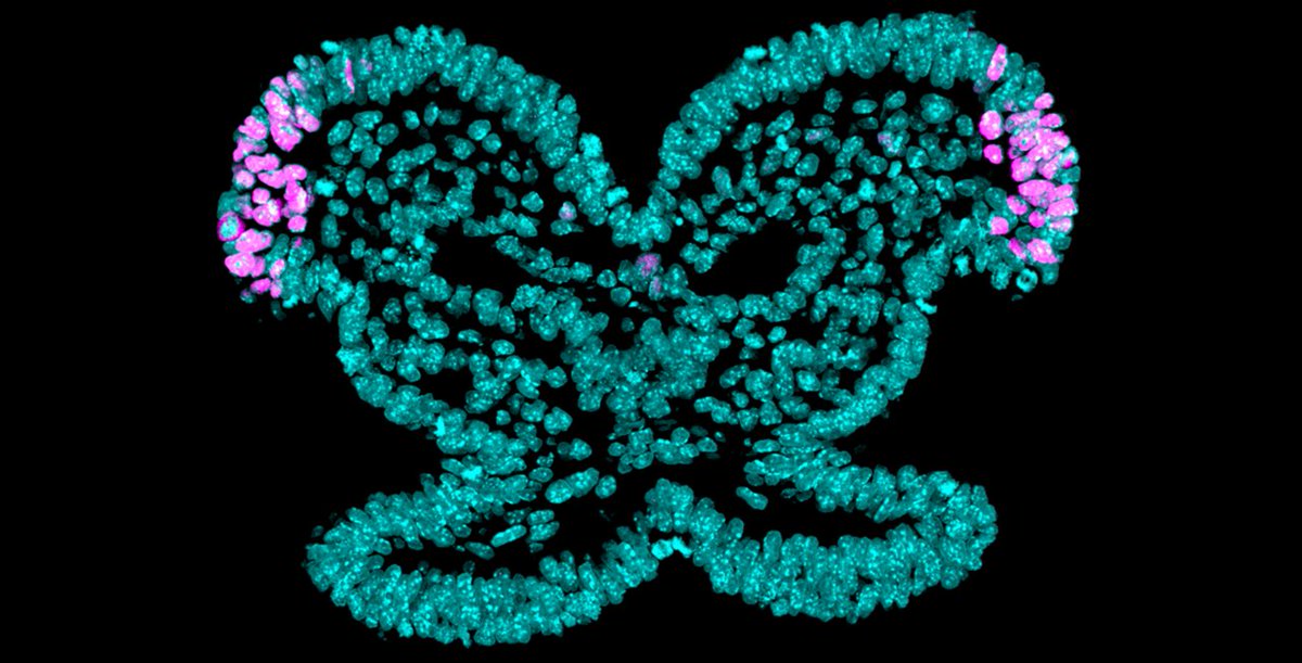 BCMFromtheLabs's tweet photo. Research by R Keuls @KeulsRachel, Dr. @ronparchem et al sets the stage to develop new strategies to repair human #craniofacialBirthDefects. #regenerativeMedicine #neuralCrestCells #microRNA @PNASNews @BCMGradSchool @BCM_GradDiverse  https://t.co/blVArJLABL @bcmhouston https://t.co/VZL0vnBgn4