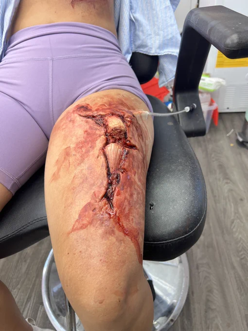 //fake goreFire Country broken leg I sculpted last summer. I love sculpting gore but man, I wish I could redo that femur. Bad femur.Ran and applied but my lovely coworkers. 