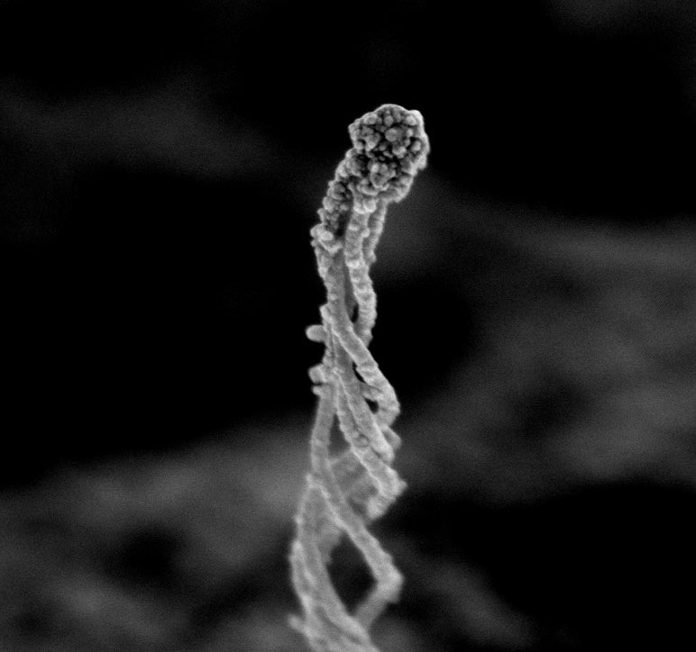 Jing Hughes (@jinghughes) on Twitter photo Behold, the cilia tip 😍
This and more images from human islets in our preprint:
biorxiv.org/content/10.110…
SEM by the inimitable Sanja Sviben at <a href="/wuccilab/">WashU Center for Cellular Imaging</a> Behold, the cilia tip 😍
This and more images from human islets in our preprint:
biorxiv.org/content/10.110…
SEM by the inimitable Sanja Sviben at <a href="/wuccilab/">WashU Center for Cellular Imaging</a>