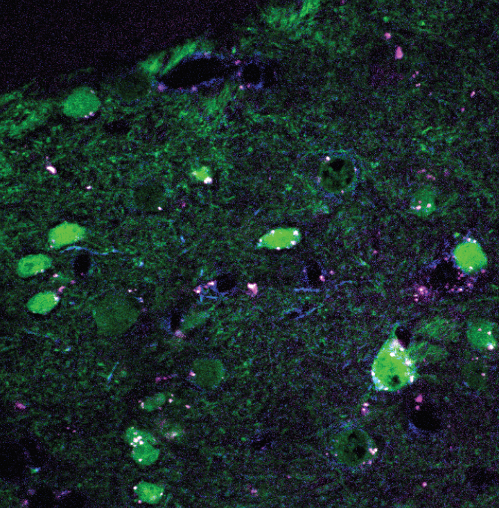 JordanYorgason's tweet photo. First time labeling with a conjugated toxin (blue) worked out great. NAc GABA neurons in green https://t.co/YMZw7MrQt3