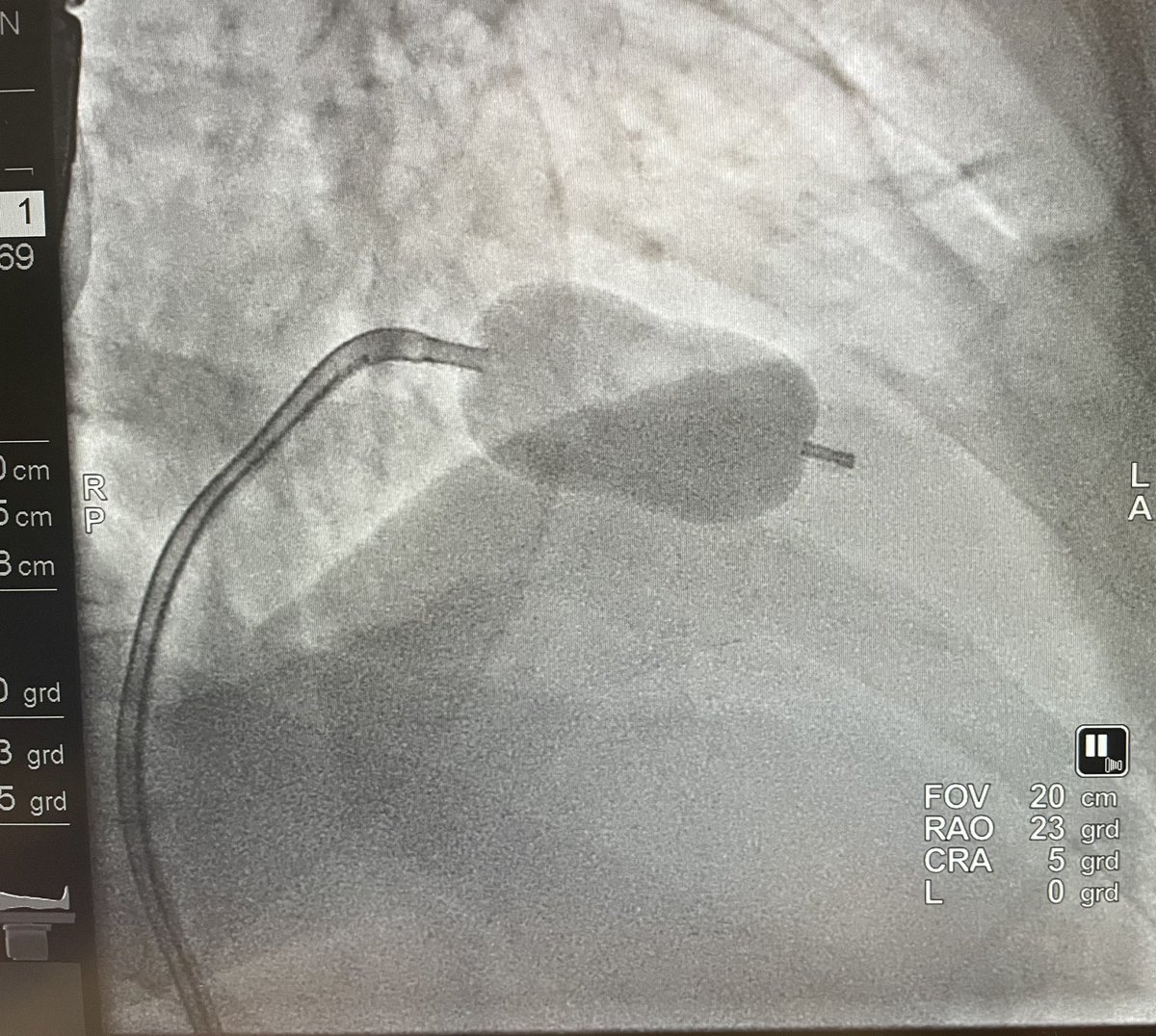de_clinico's tweet photo. Hoy se han juntado en el CathLab la el "presente-futuro" del intervencionismo valvular y parte del "pasado"... qué profesión más apasionante! @saludand @clinicogranada @cardioclinicoGr @shci_sec https://t.co/SBmipmcUeD
