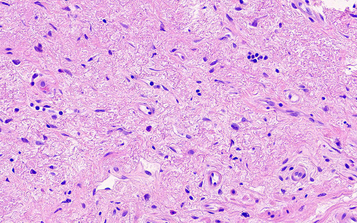 Tristan Rutland MBBS FRCPA IFCAP tweet media