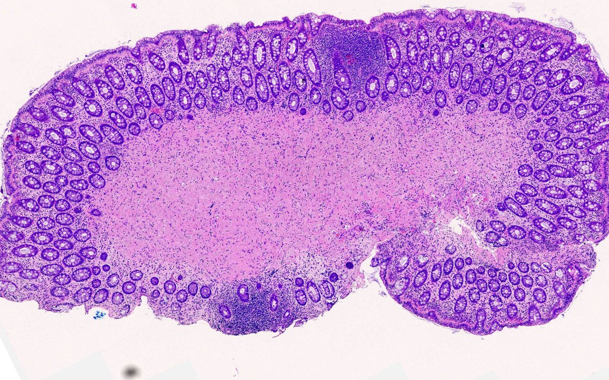 Tristan Rutland MBBS FRCPA IFCAP tweet media