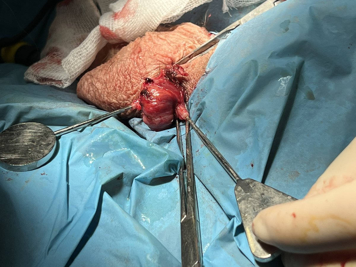 mdmancebo's tweet photo. Vasovasostomia junto al Dr Valle y Dra Dieppa!! #Urosome https://t.co/1NxQ7MiQxB