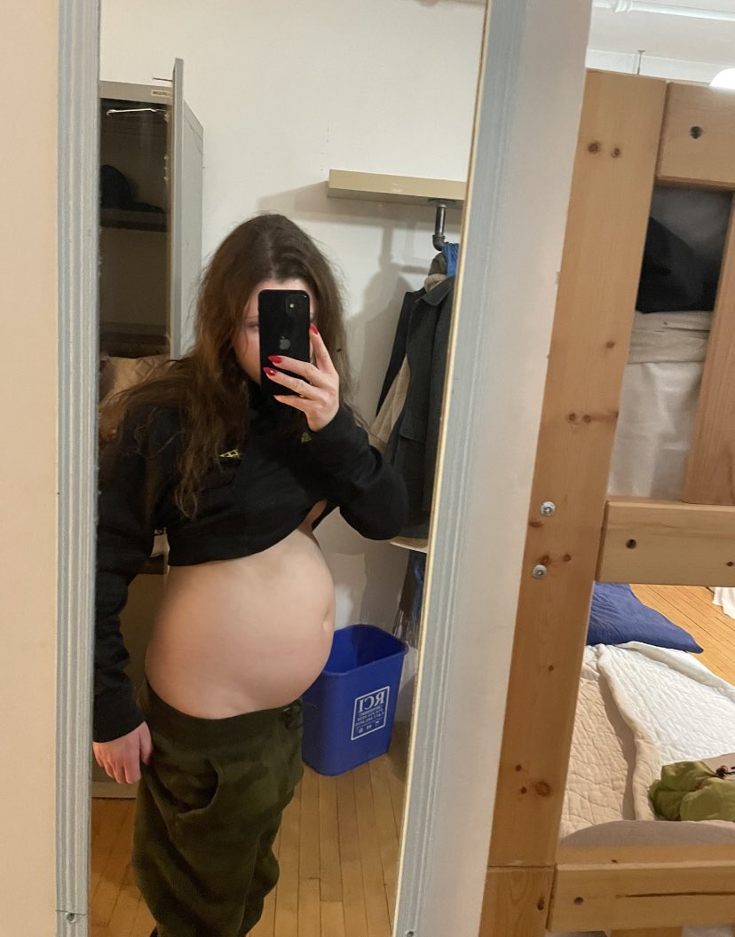 yujinbmi's tweet photo. @absolutegoner she got her karma bc this is her now https://t.co/8pFyaSufOz