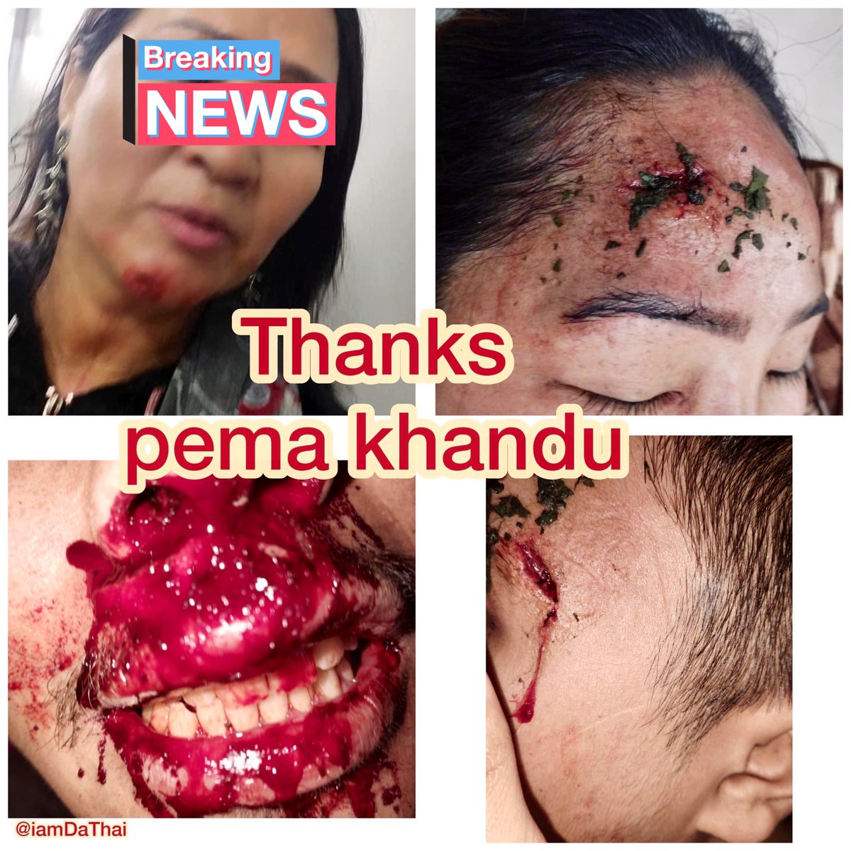 FArunachalee's tweet photo. Infuriating that I could join the protest against the appointment of a shady retired army man as the Chairman APPSC &amp; non-fulfilment of the 13-point demand. HM @bamangfelix’s law enforcers have resorted to stone pelting, injuring a few in the process.   

PC: Iam da thai (FB) https://t.co/Fu2uPGgJbR