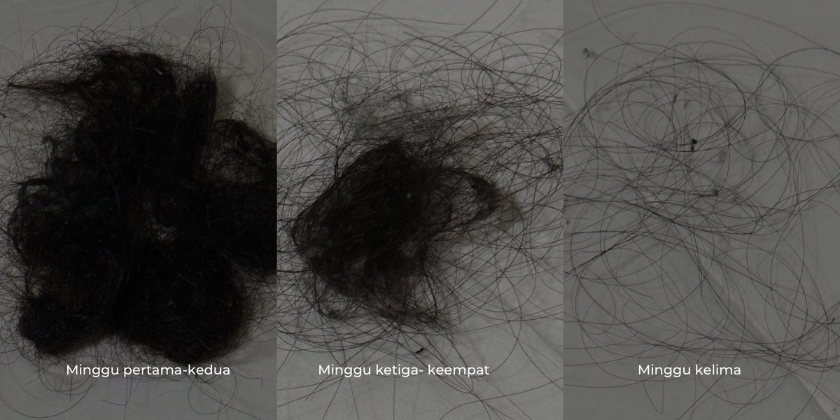 sukaskincarean's tweet photo. Tips mengatasi rambut yang rontok banget~

a thread ✨ https://t.co/4QUDPXXg48