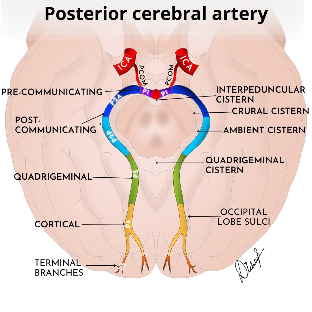 Frank Gaillard (@frankgaillard) on Twitter photo Another lovely diagram from <a href="/DrDisha_L/">Dr. Disha Lokhandwala</a> , <a href="/Radiopaedia/">Radiopaedia.org</a> rID: 161990 Having someone so talented who is happy to create gorgeous illustrations for our articles is absolutely wonderful. Another lovely diagram from <a href="/DrDisha_L/">Dr. Disha Lokhandwala</a> , <a href="/Radiopaedia/">Radiopaedia.org</a> rID: 161990 Having someone so talented who is happy to create gorgeous illustrations for our articles is absolutely wonderful.