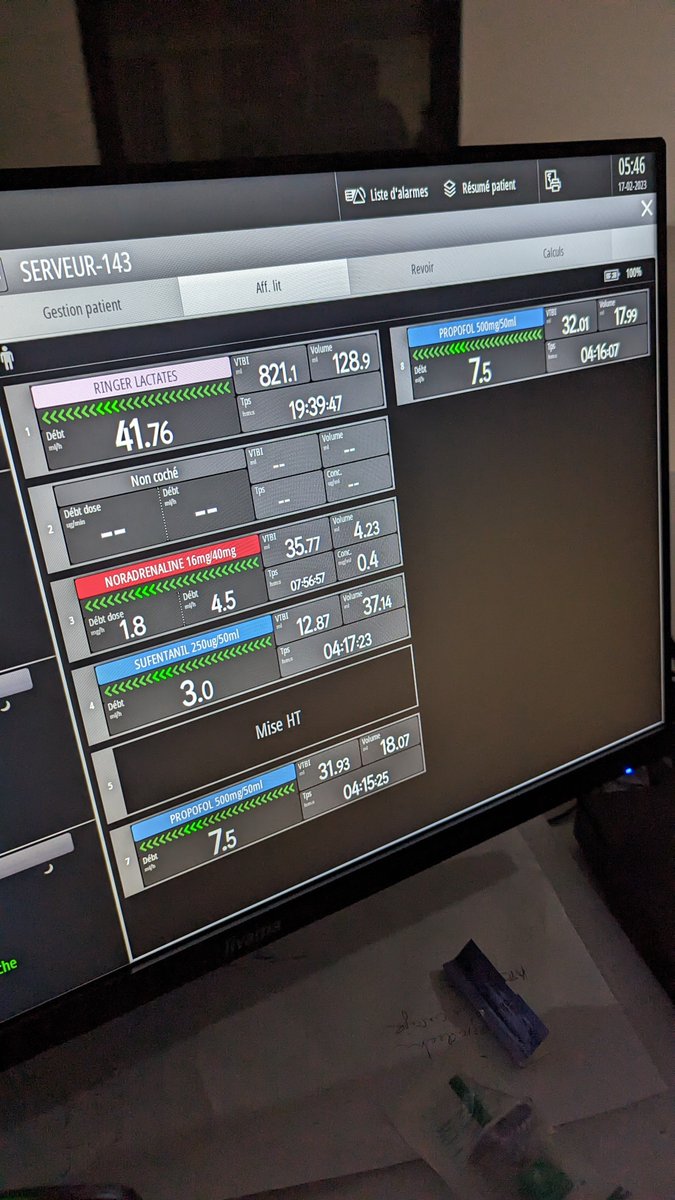 envmy's tweet image. Un écran qui te montre tes PSE (et qui affiche les alarmes) en direct depuis le poste de soin.

C'EST DONC ÇA LA VIE D'ARTISTE ?