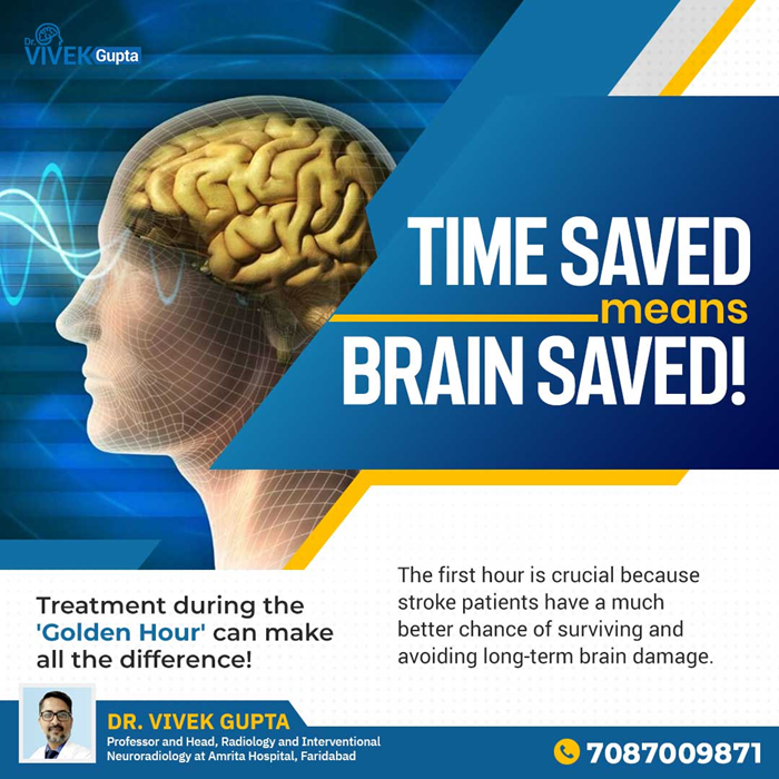 doctorvivekg's tweet photo. A stroke can have long-term consequences for your health and life. The first hour is considered critical, or "golden," because stroke patients have a high chance of survival.
https://t.co/20Vh2SD2Ct
#stroke #brainstroke #windowperiod #stroketreatment https://t.co/hLe3jym7Ti