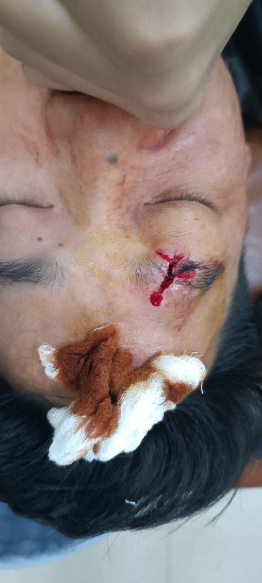 EasternSentinel's tweet photo. The state cabinet has called off the swearing-in ceremony of the Chairman &amp; members of the Arunachal Pradesh Public Service Commission after massive protest by public, parents &amp; aspirants at Itanagar on Friday. https://t.co/r3FxwspkQN