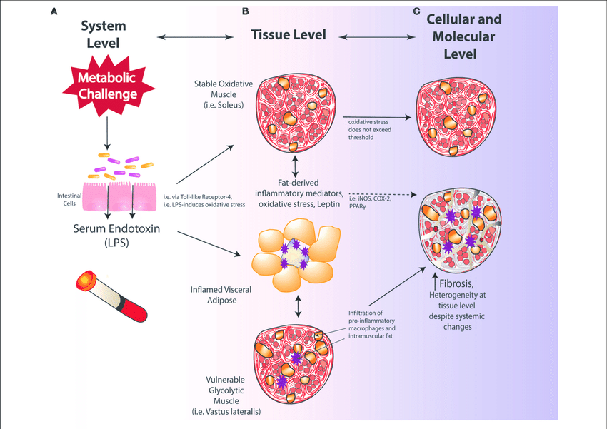 Obesity, Metabolic Syndrome, and Musculoskeletal Disease: Common Inflammatory Pathways Suggest a Central Role for Loss of Muscle Integrity

pubmed.ncbi.nlm.nih.gov/29527173/
