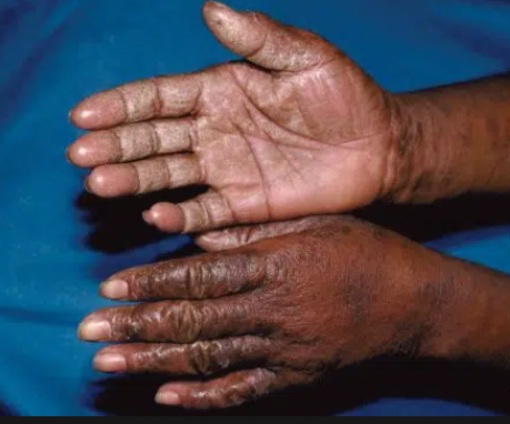 EAMedicalVitals's tweet photo. WHY LEGACY GLOVES ARE YOUR MUST-HAVE?
Our powder-free gloves help to reduce the risk of any latex allergic reactions for users and those with whom they come into contact.
For any purchases/inquiries, contact +256 757074200.
#powderfreegloves #whyus https://t.co/UIpIj2hLpU