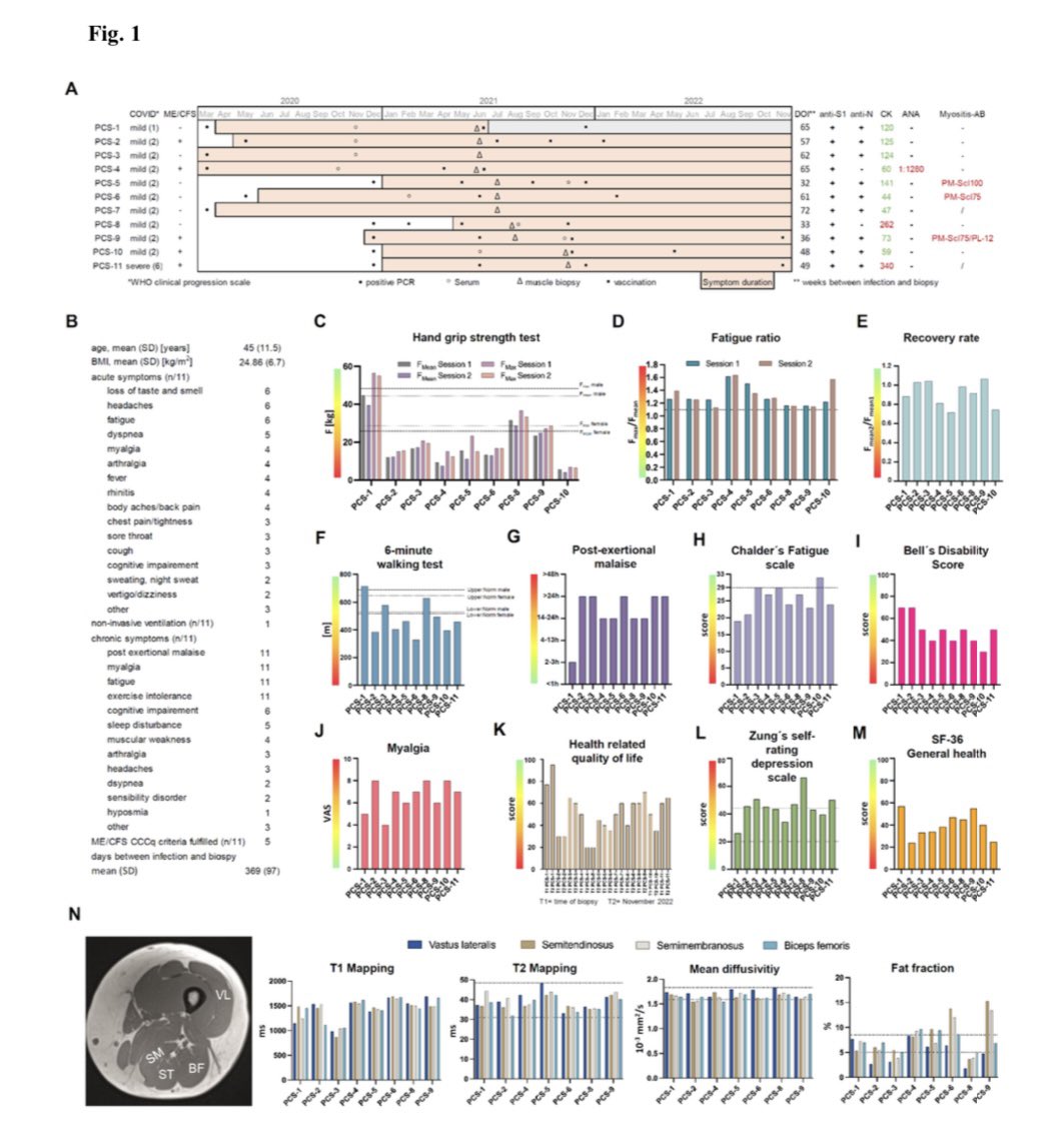 Das Post-COVID-Syndrom geht mit Kapillarveränderungen, Makrophageninfiltration und ausgeprägten transkriptomischen Signaturen in Skelettmuskeln einher

Im Rahmen dieser Studie wurde eine eingehende Analyse von Skelettmuskelbiopsien vorgenommen,…

#MECFS #LongCovid #COVID19