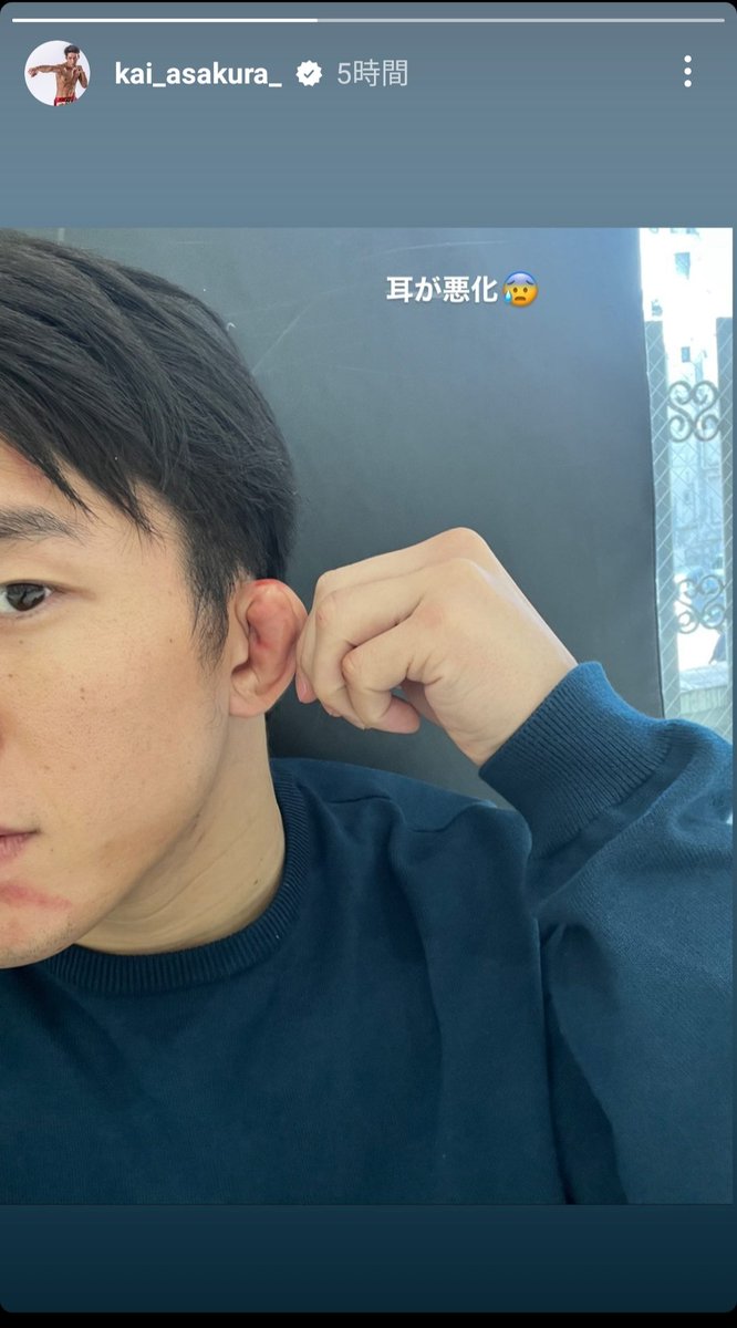 dominate_f's tweet photo. 本人も言ってるけど、以前より明らかに耳が潰れてるな https://t.co/1G6Sx3MIit