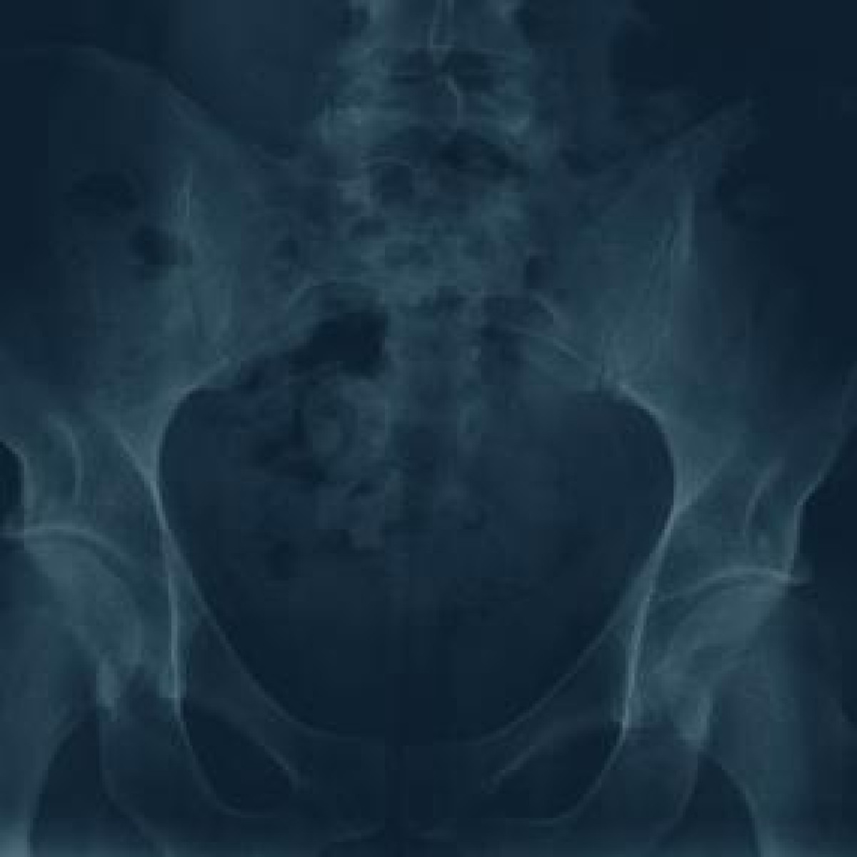 boomkatonline's tweet image. Our thoughts on all this week's releases in one place...

bit.ly/3YF0GwR