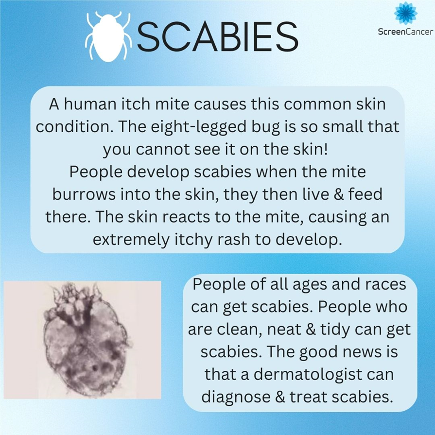 ScreenCancer_UK's tweet image. Do you know what #scabies are? Together lets learn and break the stigma around the very common #skincondition