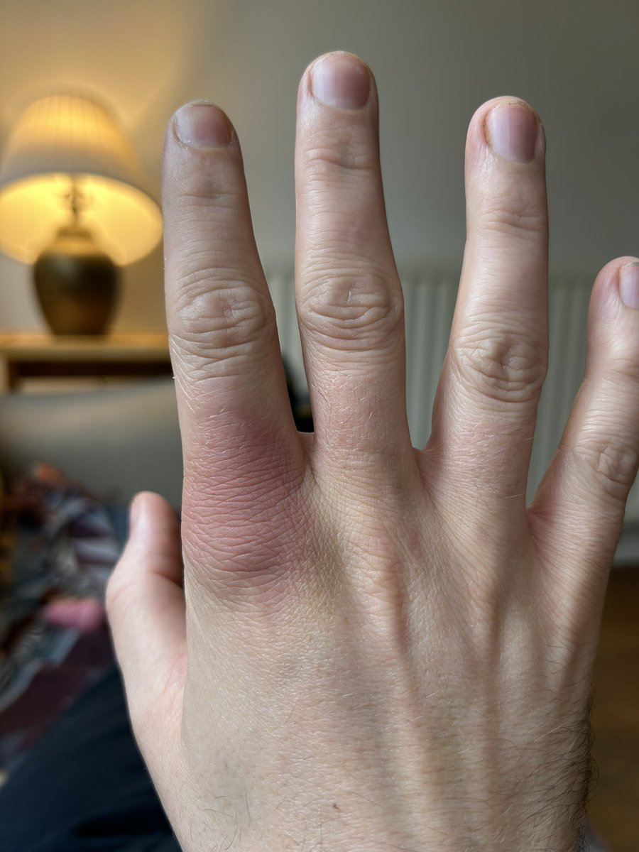 Luke McGee on Twitter "Last night I accidentally punched someone’s