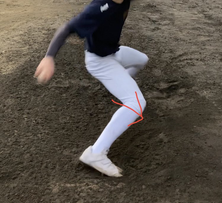 med_orp's tweet photo. 背中の緊張が強く腰が反った姿勢は、四頭筋（太ももの前）に力が入りやすくなります。

結果的にハム、臀筋が使えない膝が前に折れたフォームになります。

この動きでは投球方向にしっかり力が伝わらず、意図しないインステップになるので注意が必要です。
#高校野球
#大学野球
#med野球
#球速アップ https://t.co/oWa5ts1Drw