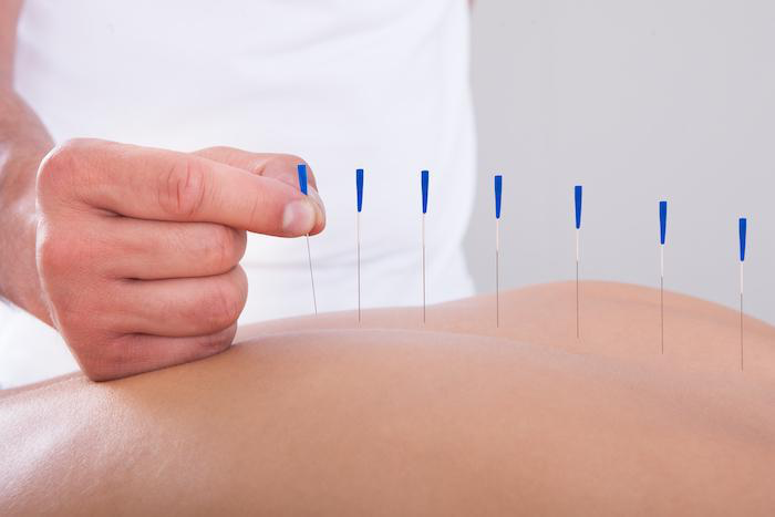 chrisboettcher9's tweet photo. The greatest recovery tool you've likely never heard of:

Therapeutic Dry Needling

Let's break down what it is and why it could be the solution to your chronic pain: https://t.co/U9JnsHI4C4