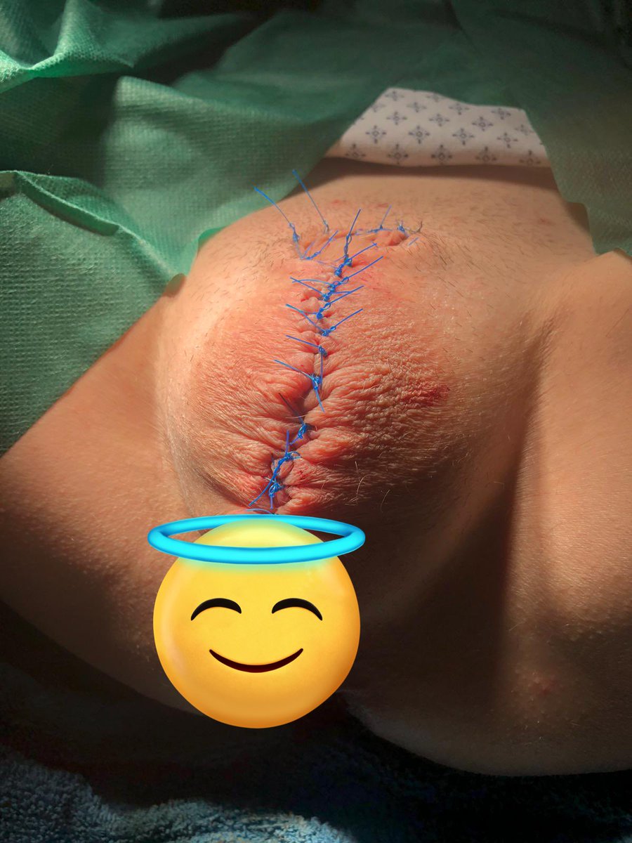 Love to transform my male patients😍 What do you think?

#klinikfetisch #medicalfetish #medicalmistress #dominatrix #Nähspiele #medfet #fetischklinik #klinikerin #bdsm #kinky