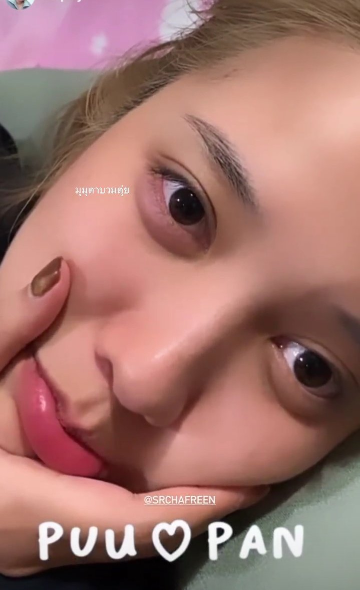 for_freenbeck's tweet photo. "my eyes are swollen" 🥺
#srchafreen https://t.co/9Wkqmemz2Q