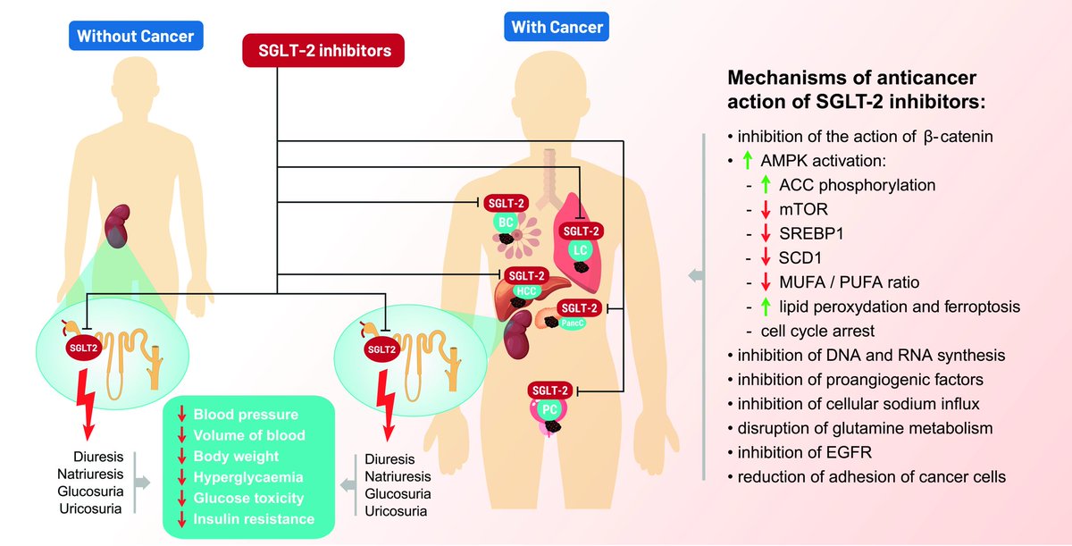 AndroMetabolic's tweet photo. 💊 El uso de inhibidores del transportador SGLT2 #iSGLT2 parece ⬆️ la supervivencia (⬇️ la mortalidad) de pacientes con #cáncer de pulmón y #diabetes preexistente
⚡Esto se suma a sus beneficios endocrino-metabólicos, nefro-protectores y ⬇️ del #RCV
🔗https://t.co/7y0jSSKbeb https://t.co/CpCMbTLTdp