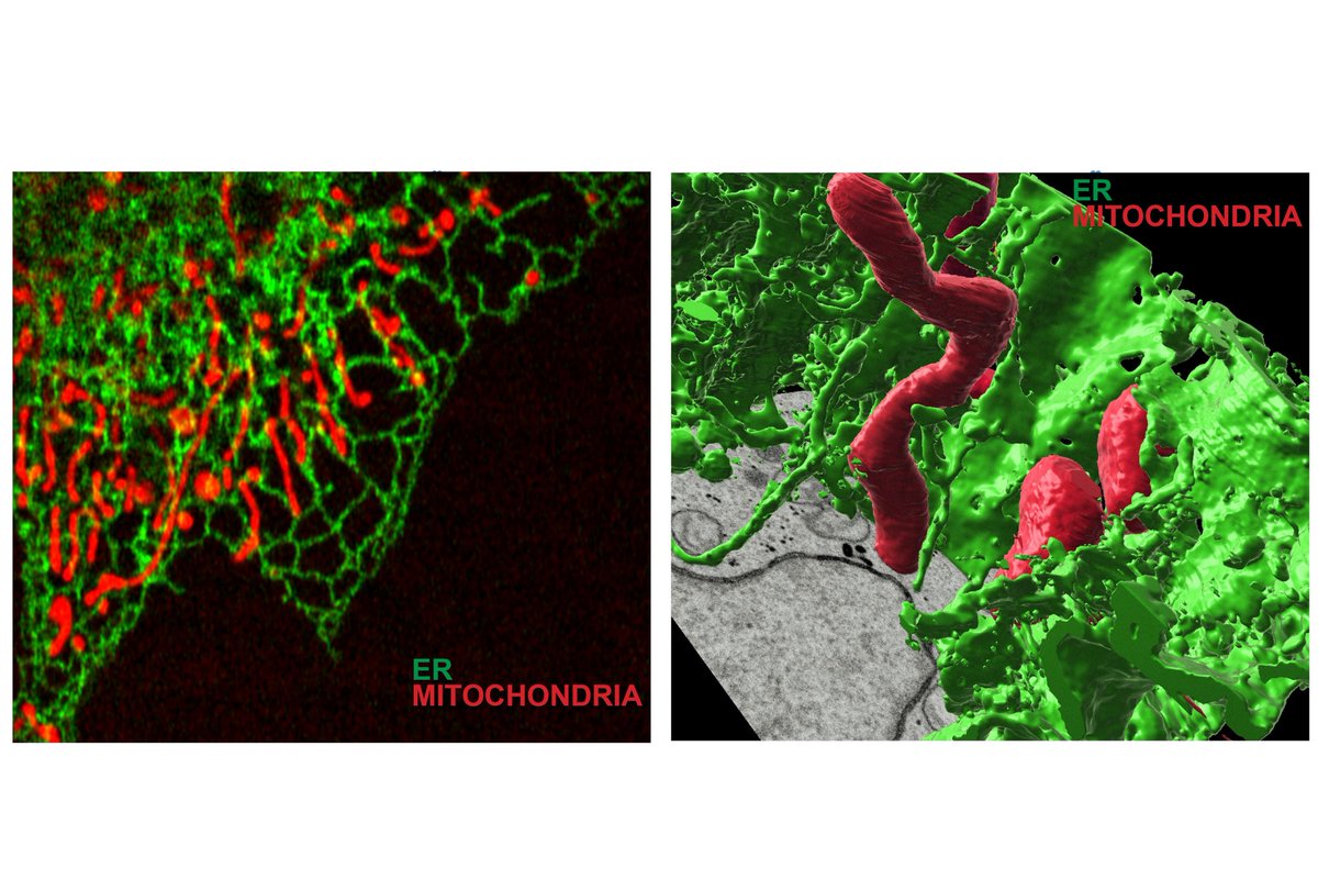 Agostinis Lab (@agostinislab) on Twitter photo Exciting possibility‼️A PI position available at <a href="/KU_Leuven/">KU Leuven</a> in our Department of Cellular and Molecular Medicine (CMM) for #MembraneContactSites research. Please see below for details or contact <a href="/AgostinisLab/">Agostinis Lab</a> please RT. 
Info: kuleuven.be/personeel/jobs… 
CMM: gbiomed.kuleuven.be/english/resear… Exciting possibility‼️A PI position available at <a href="/KU_Leuven/">KU Leuven</a> in our Department of Cellular and Molecular Medicine (CMM) for #MembraneContactSites research. Please see below for details or contact <a href="/AgostinisLab/">Agostinis Lab</a> please RT. 
Info: kuleuven.be/personeel/jobs… 
CMM: gbiomed.kuleuven.be/english/resear…
